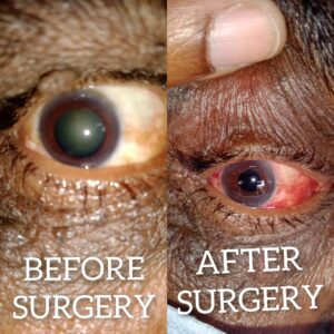 Eye Care Surgeries by Dr. Nalluri Prasanthi