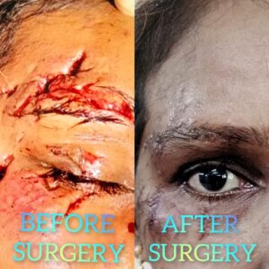Eye Care Surgeries by Dr. Nalluri Prasanthi
