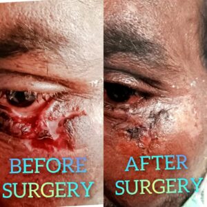 Eye Care Surgeries by Dr. Nalluri Prasanthi