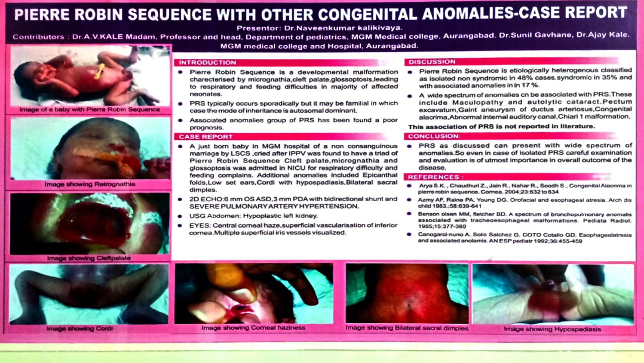 PIERRE ROBIN SEQUENCE WITH OTHER CONGENITAL ANOMALIES at pedicon 2016 Hyderabad.