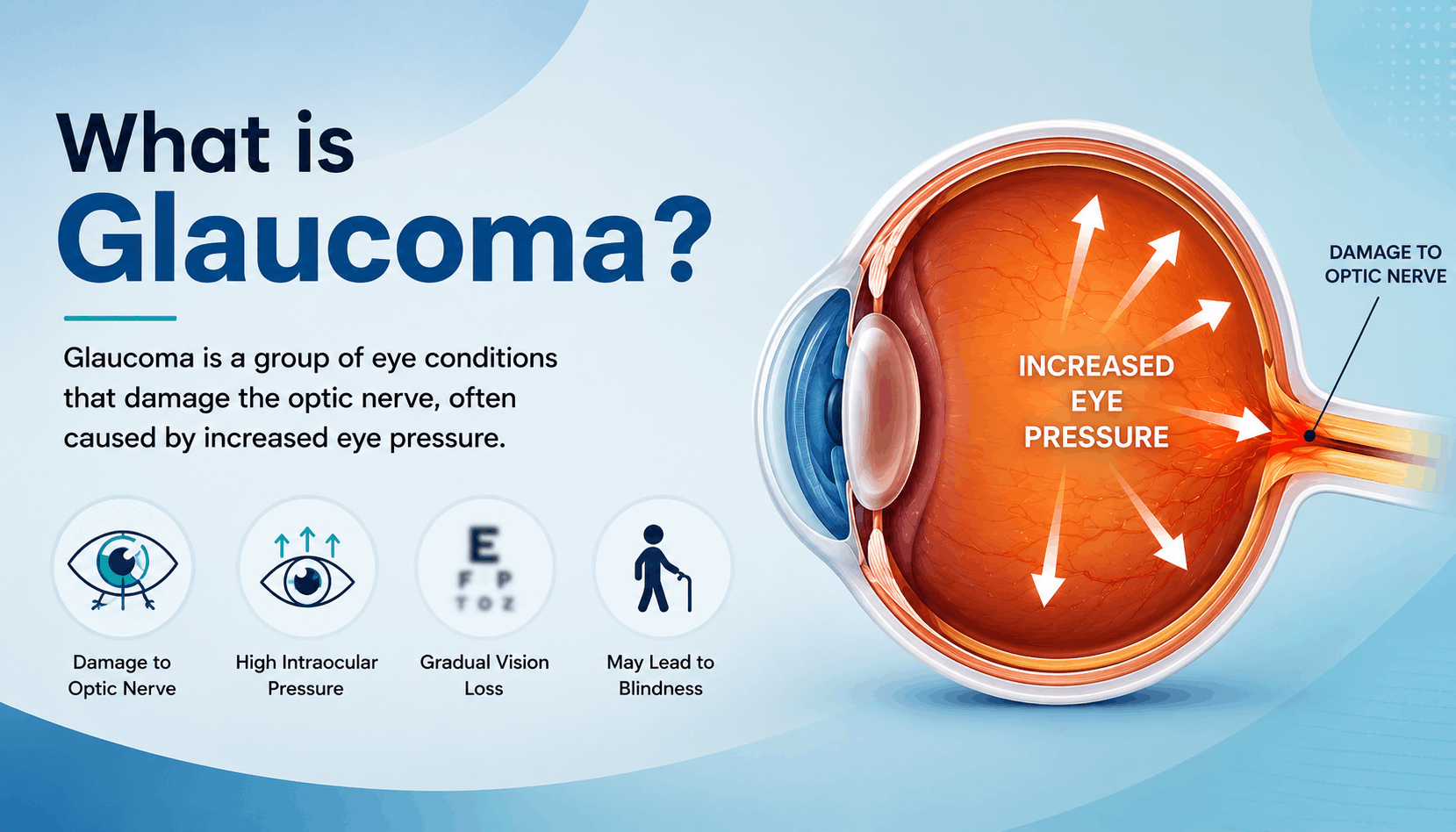 glaucoma symptoms