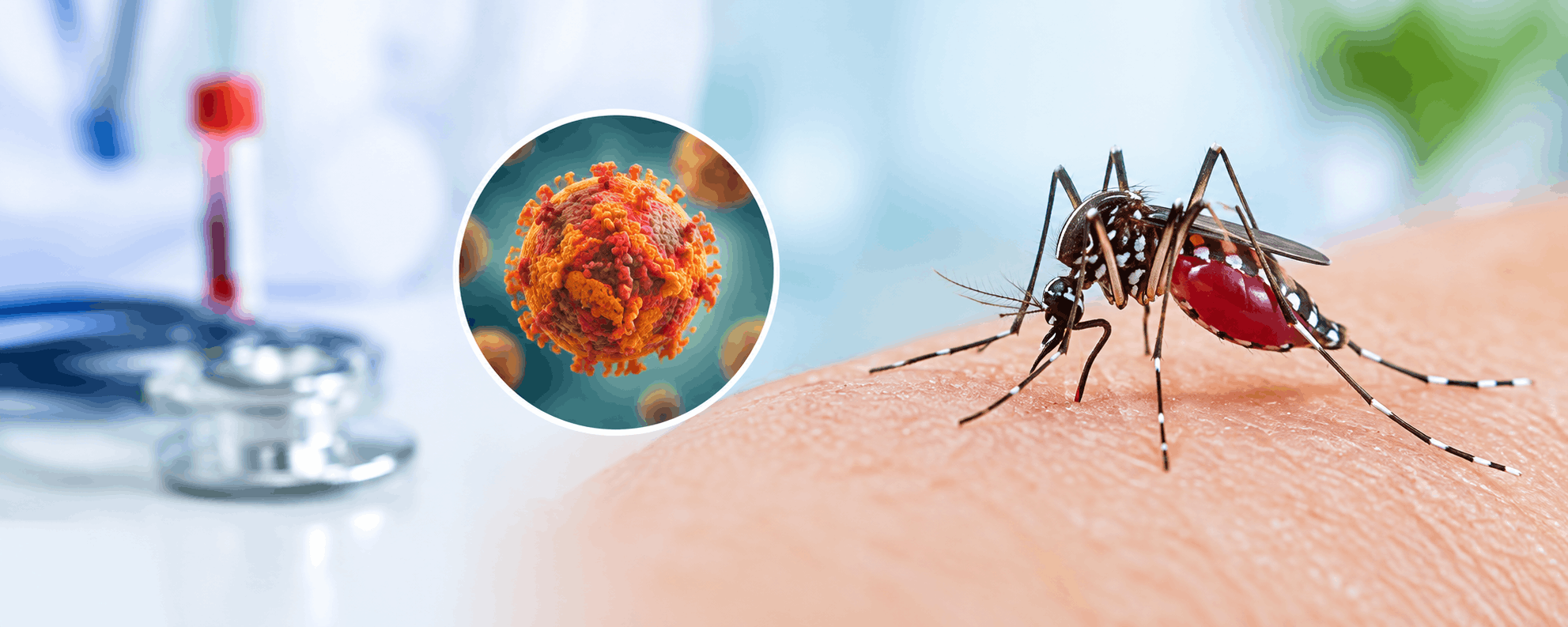 Dengue symptoms
