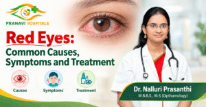Red Eyes: Common Causes, Symptoms and Treatment